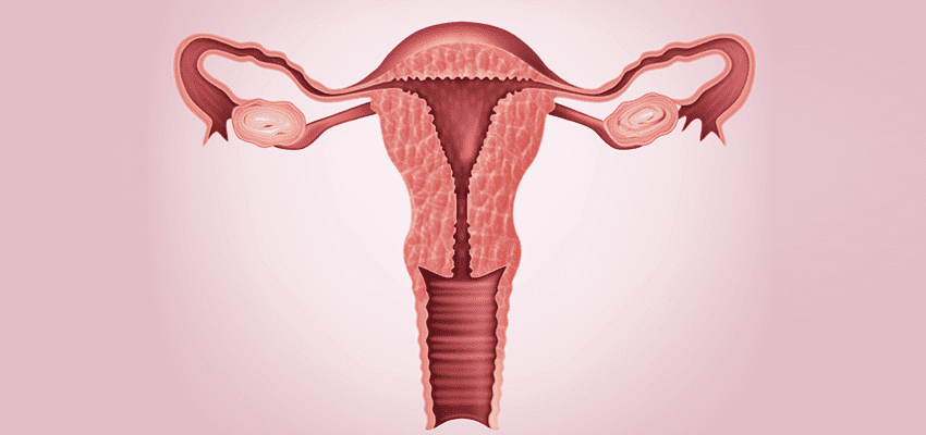 Histerectomia Vaginal